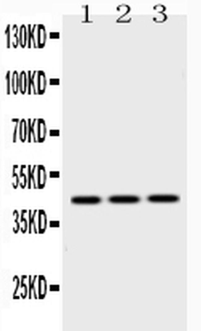 EBP1 Antibody in Western Blot (WB)