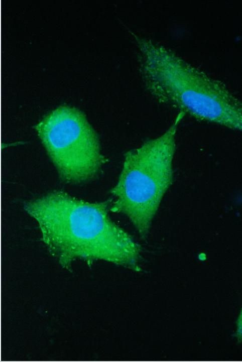 PARN Antibody in Immunocytochemistry (ICC/IF)