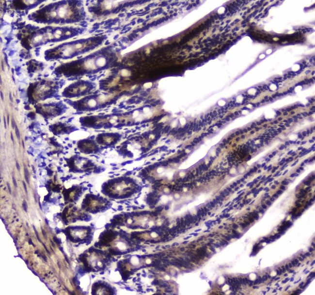 PARN Antibody in Immunohistochemistry (Paraffin) (IHC (P))