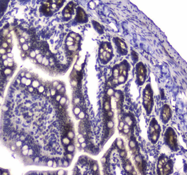 PARN Antibody in Immunohistochemistry (Paraffin) (IHC (P))