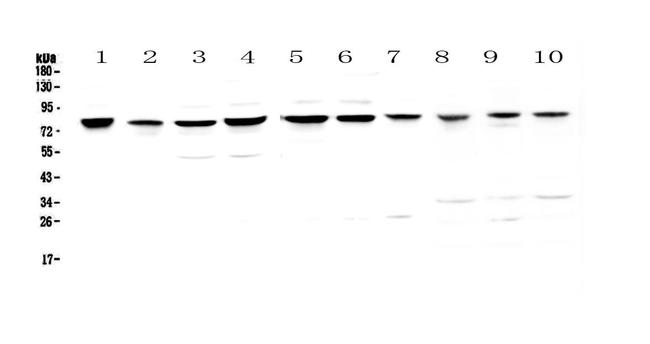 PARN Antibody in Western Blot (WB)