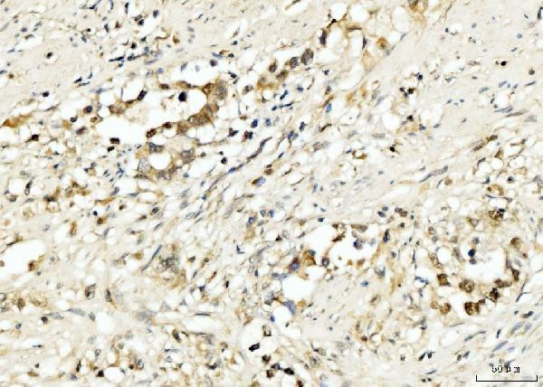 PDCD4 Antibody in Immunohistochemistry (Paraffin) (IHC (P))