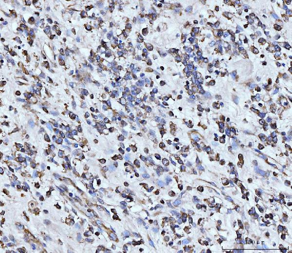 PDCD4 Antibody in Immunohistochemistry (Paraffin) (IHC (P))