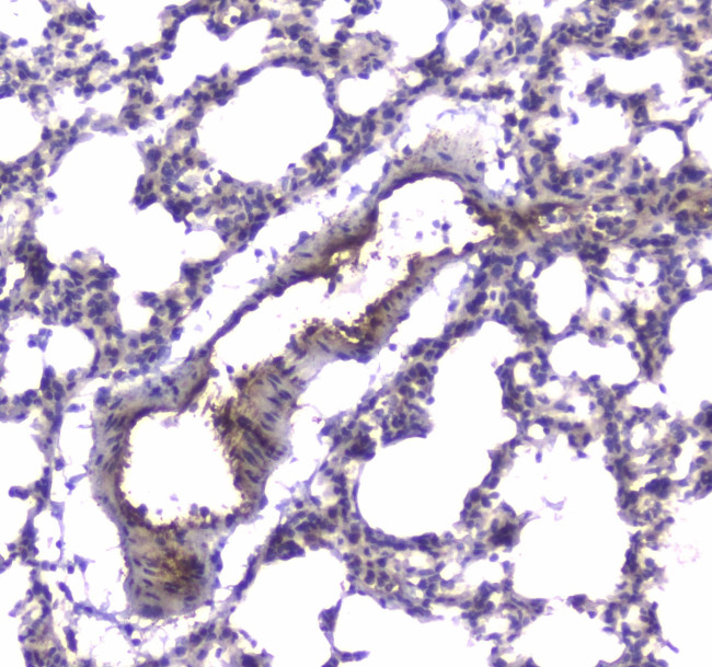 PDE4D Antibody in Immunohistochemistry (Paraffin) (IHC (P))