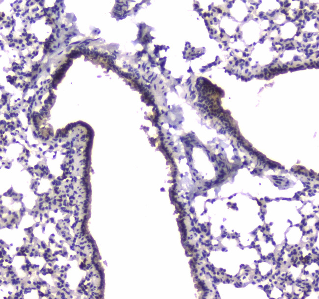 PDE4D Antibody in Immunohistochemistry (Paraffin) (IHC (P))