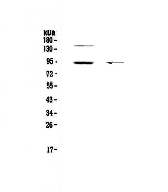 PDE4D Antibody in Western Blot (WB)