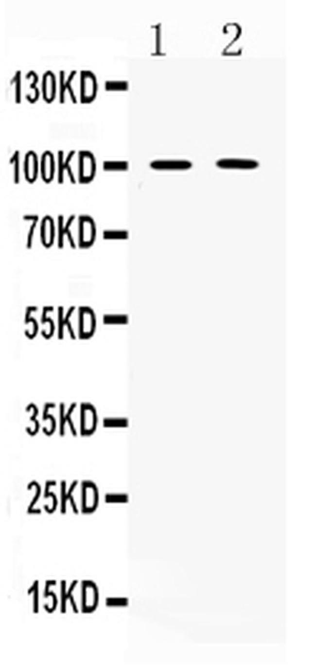 PDE5 Antibody in Western Blot (WB)