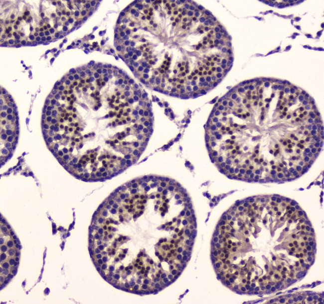 PDK1 Antibody in Immunohistochemistry (Paraffin) (IHC (P))