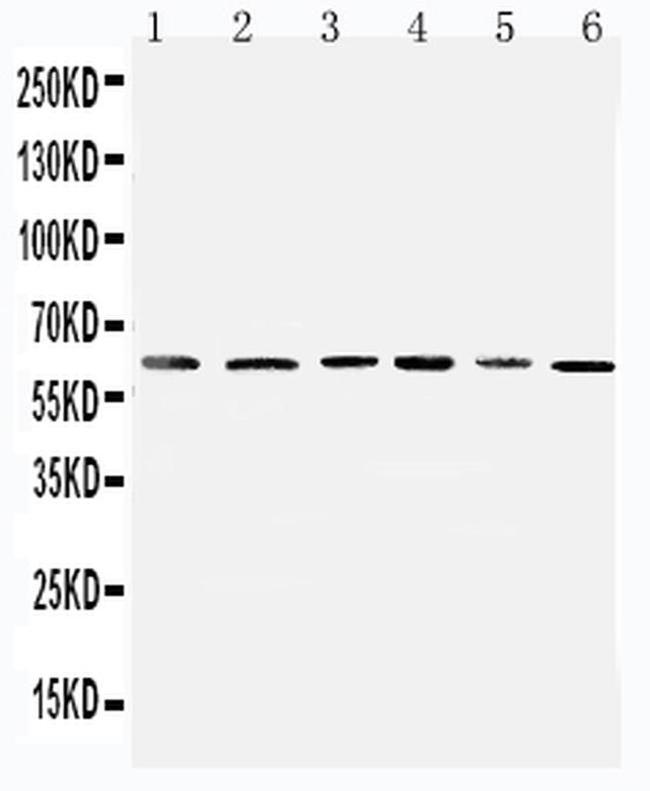 PDK1 Antibody in Western Blot (WB)