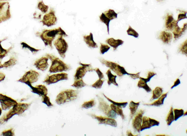 PDK2 Antibody in Immunocytochemistry (ICC/IF)