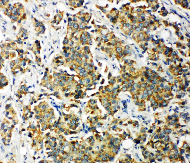 PDK2 Antibody in Immunohistochemistry (Paraffin) (IHC (P))