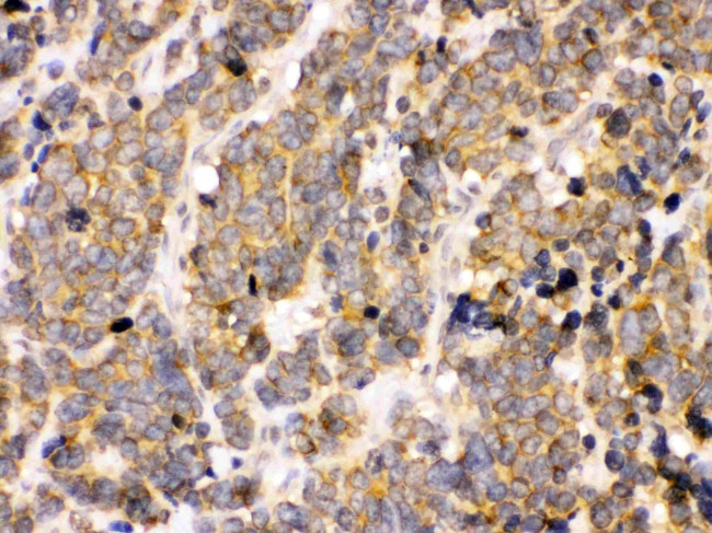 PDPK1 Antibody in Immunohistochemistry (Paraffin) (IHC (P))