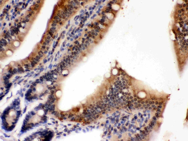 PDPK1 Antibody in Immunohistochemistry (Paraffin) (IHC (P))