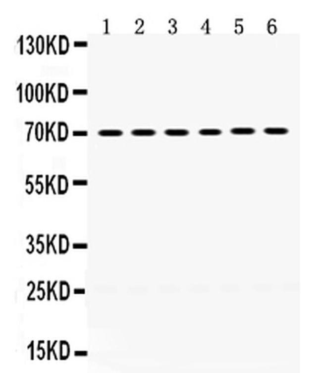 PDPK1 Antibody in Western Blot (WB)