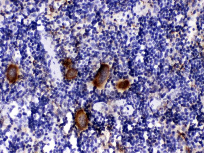 PF4 Antibody in Immunohistochemistry (Paraffin) (IHC (P))