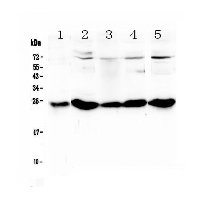 PGF Antibody in Western Blot (WB)