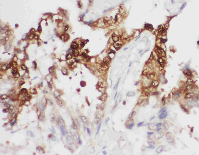 PGK1 Antibody in Immunohistochemistry (Paraffin) (IHC (P))