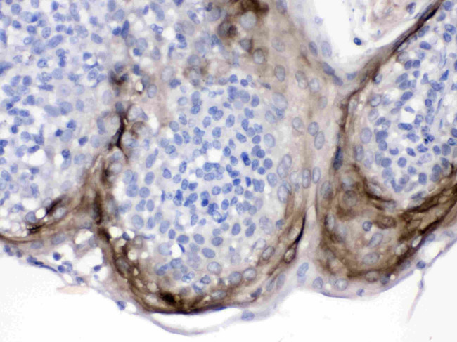 PI3 Antibody in Immunohistochemistry (Paraffin) (IHC (P))