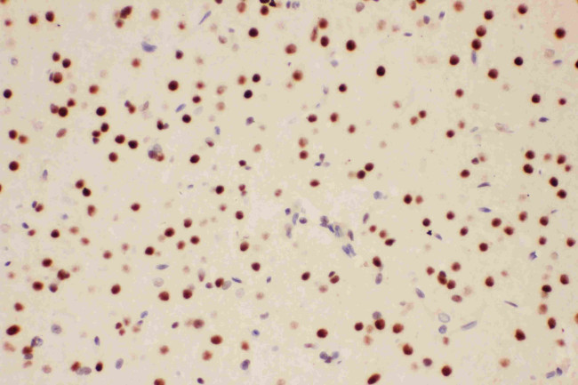 PIAS1 Antibody in Immunohistochemistry (Paraffin) (IHC (P))