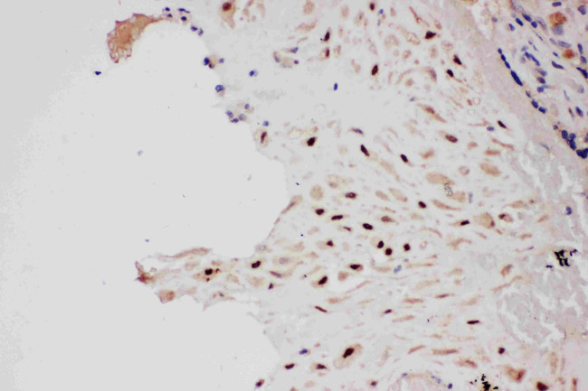 PIAS1 Antibody in Immunohistochemistry (Paraffin) (IHC (P))