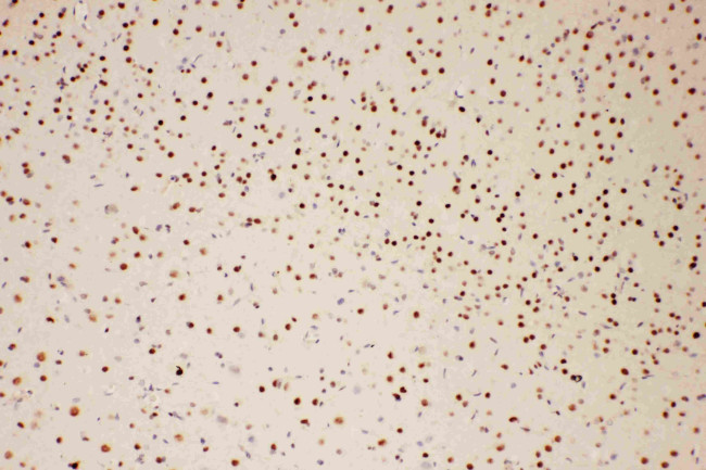 PIAS1 Antibody in Immunohistochemistry (Paraffin) (IHC (P))