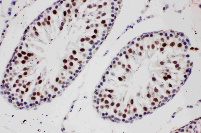 PIAS1 Antibody in Immunohistochemistry (Paraffin) (IHC (P))