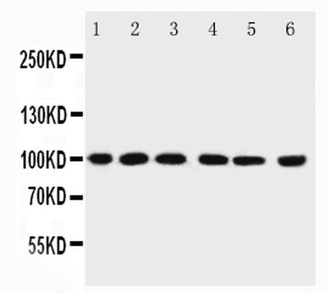 PIAS1 Antibody in Western Blot (WB)