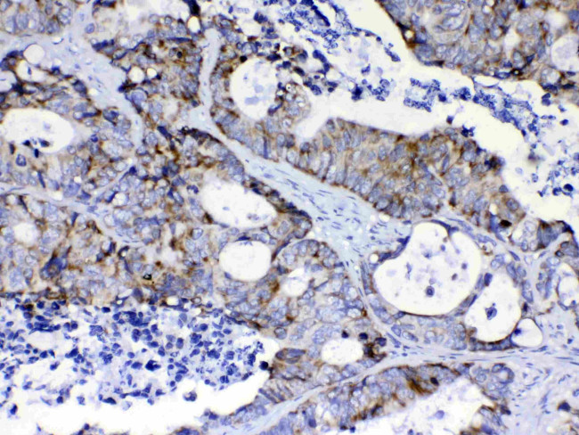 PIK3CB Antibody in Immunohistochemistry (Paraffin) (IHC (P))