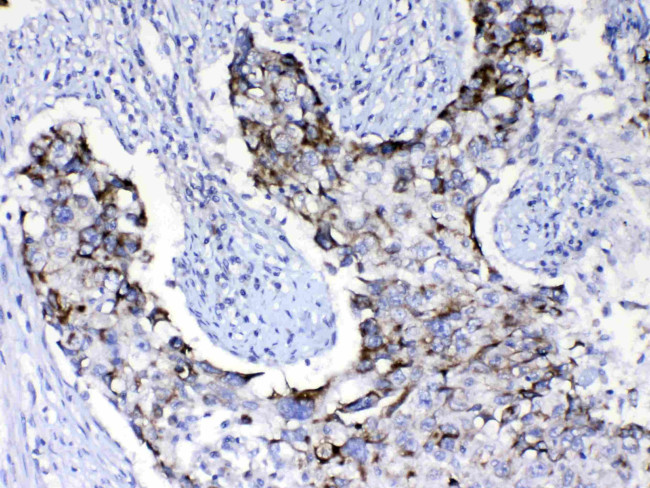 PIK3CB Antibody in Immunohistochemistry (Paraffin) (IHC (P))