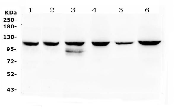 PIK3CB Antibody in Western Blot (WB)