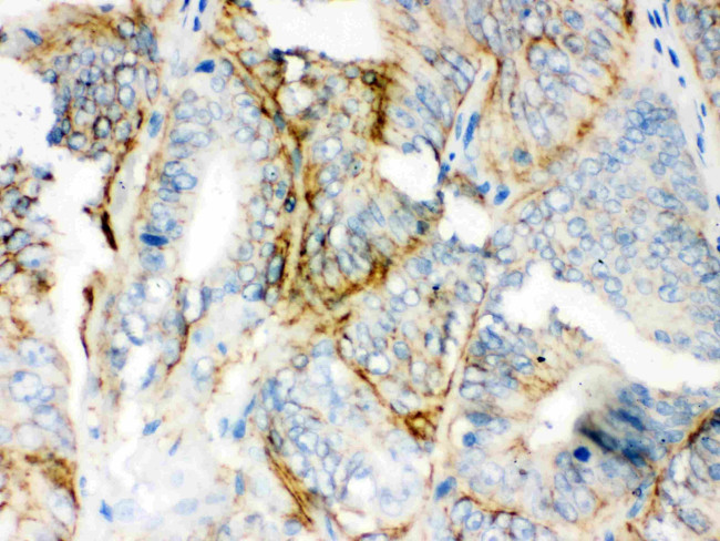 PKLR Antibody in Immunohistochemistry (Paraffin) (IHC (P))