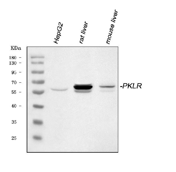 PKLR Antibody in Western Blot (WB)