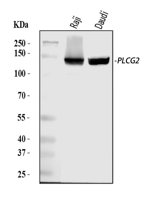 PLCG2 Antibody in Western Blot (WB)