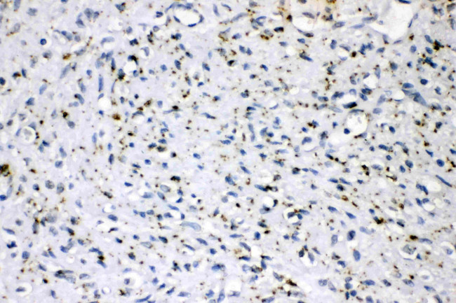 ADFP Antibody in Immunohistochemistry (Paraffin) (IHC (P))