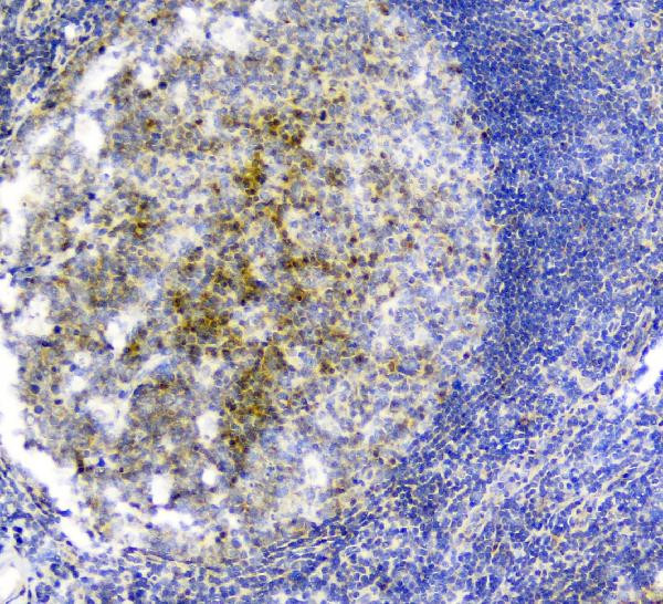 PLK2 Antibody in Immunohistochemistry (Paraffin) (IHC (P))