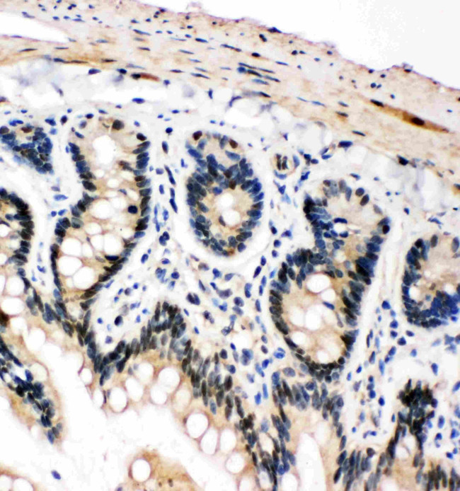 PLK2 Antibody in Immunohistochemistry (Paraffin) (IHC (P))