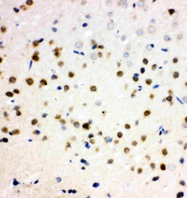 PLK2 Antibody in Immunohistochemistry (Paraffin) (IHC (P))