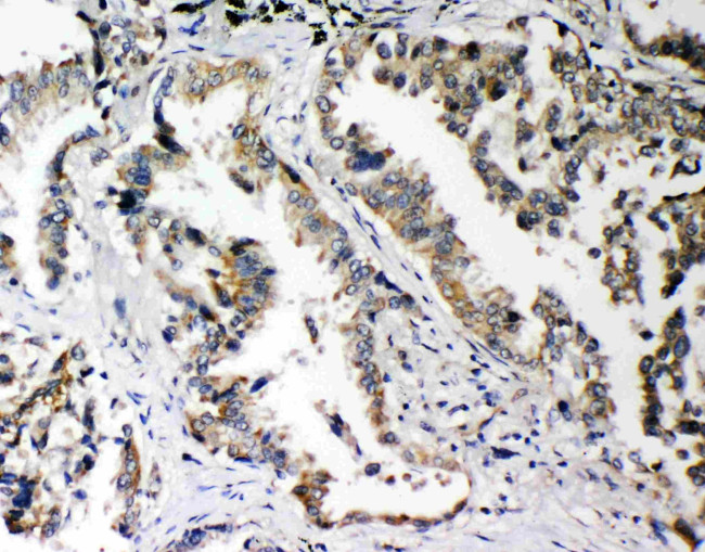 PLK2 Antibody in Immunohistochemistry (Paraffin) (IHC (P))