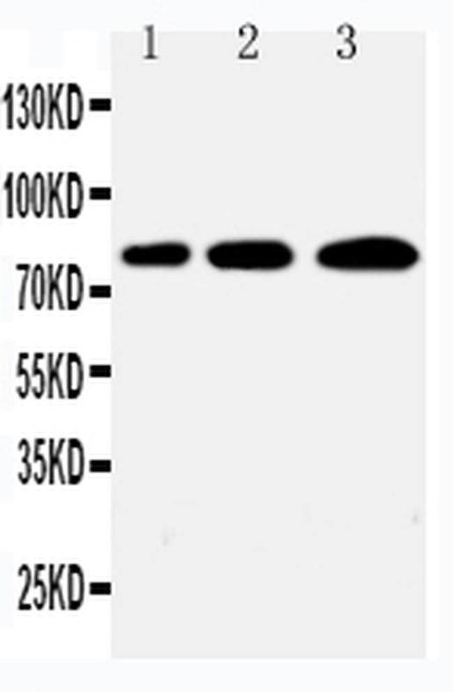 PLK2 Antibody in Western Blot (WB)