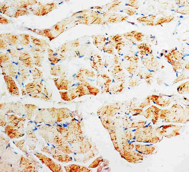 PMVK Antibody in Immunohistochemistry (Paraffin) (IHC (P))