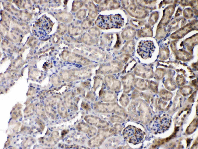 PNP Antibody in Immunohistochemistry (Paraffin) (IHC (P))