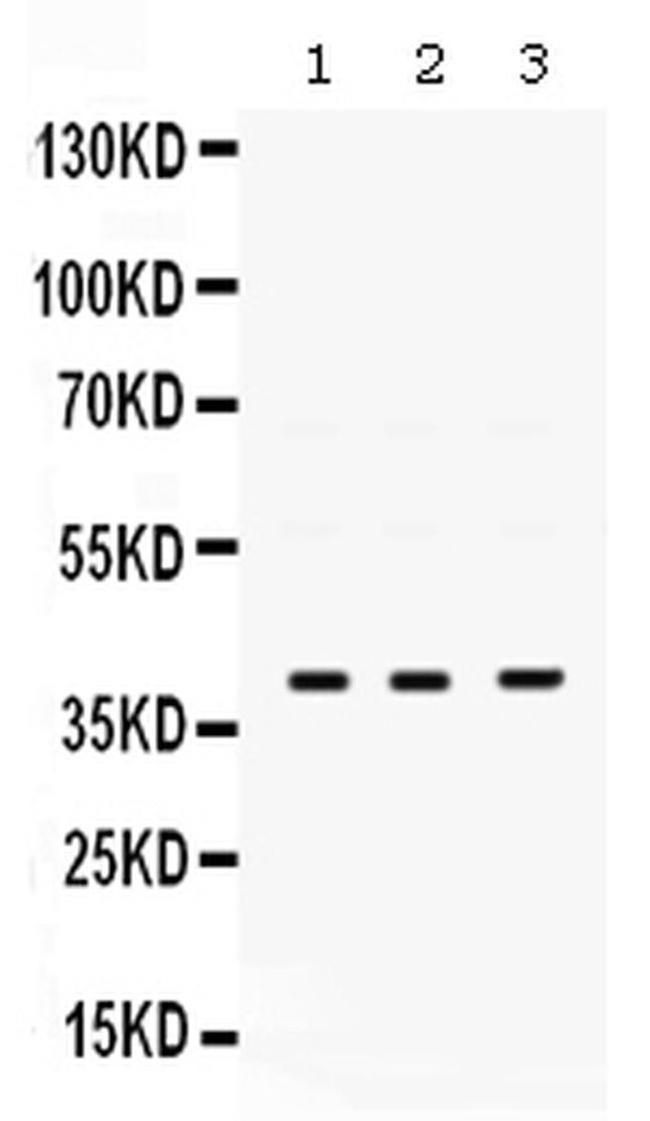 POLB Antibody in Western Blot (WB)