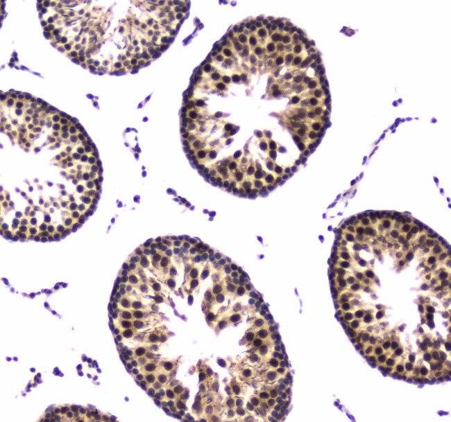 POLR2A Antibody in Immunohistochemistry (Paraffin) (IHC (P))