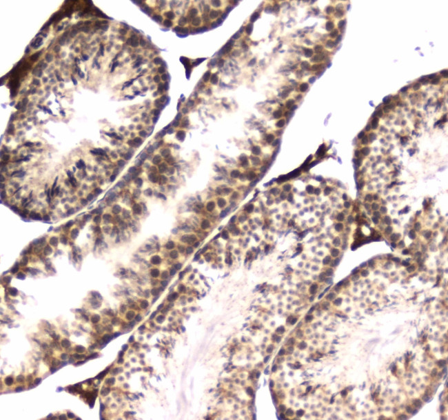 POLR2A Antibody in Immunohistochemistry (Paraffin) (IHC (P))