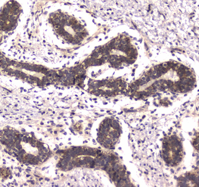 POLR2A Antibody in Immunohistochemistry (Paraffin) (IHC (P))