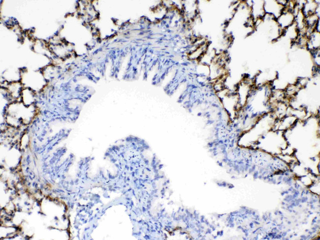 Periostin Antibody in Immunohistochemistry (Paraffin) (IHC (P))