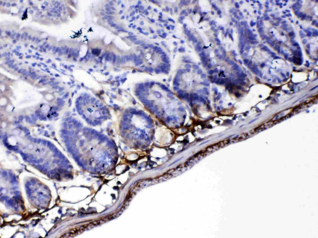 Periostin Antibody in Immunohistochemistry (Paraffin) (IHC (P))