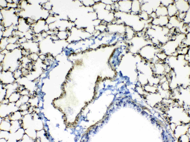 Periostin Antibody in Immunohistochemistry (Paraffin) (IHC (P))