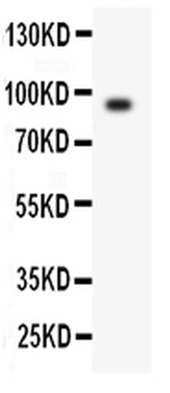 Periostin Antibody in Western Blot (WB)