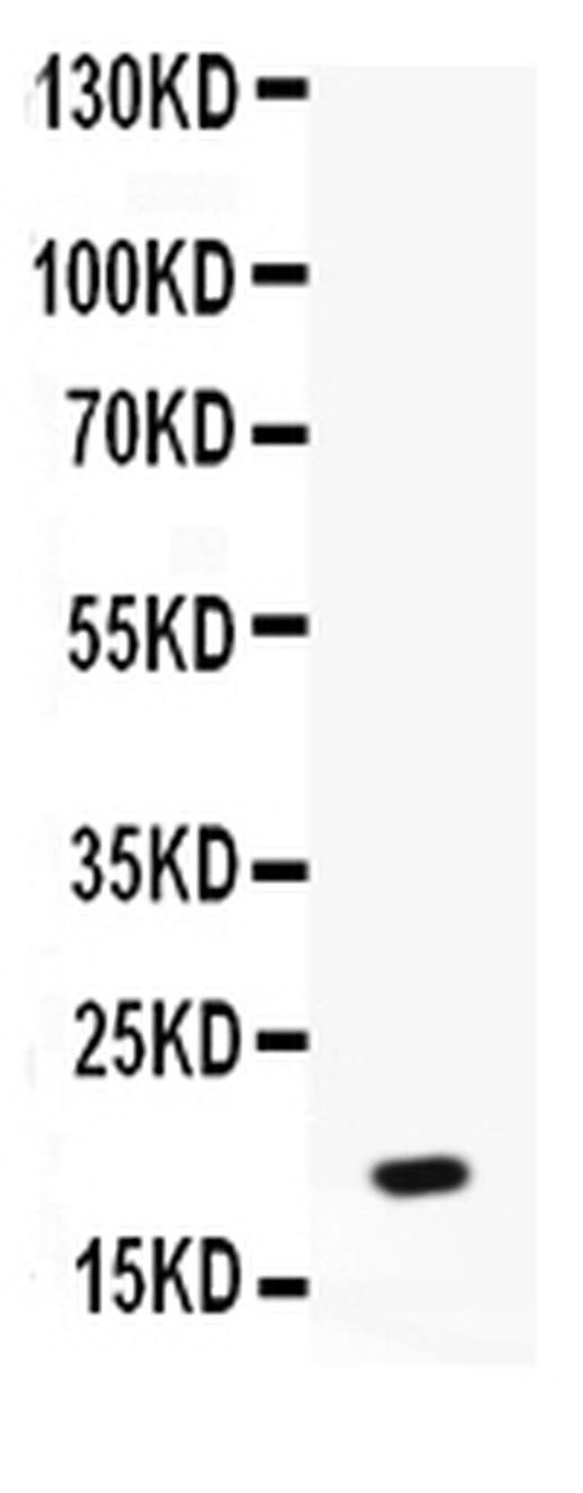 PPBP Antibody in Western Blot (WB)